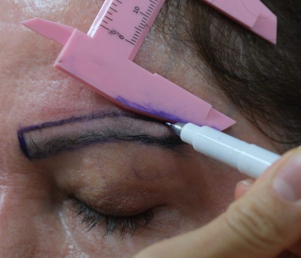 Hair,Transplant,Man,Women,Fue,Dhi,Sapphire,Hair,Care