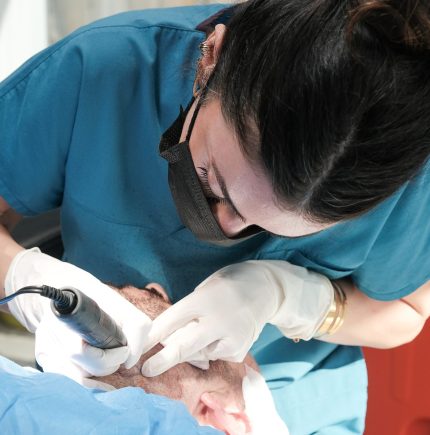 The,Doctor,Is,Extracting,Follicles,From,The,Patient's,Beard,Area