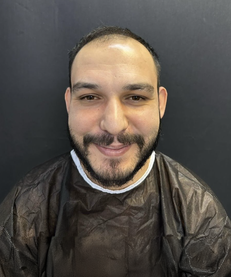 Before image