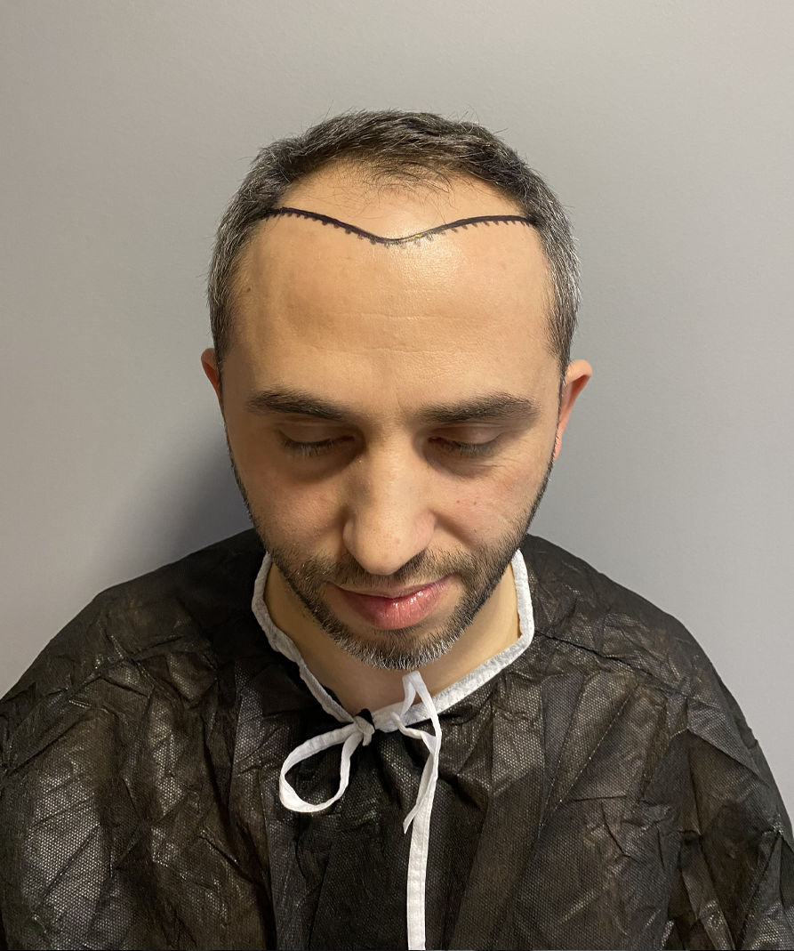 Before image